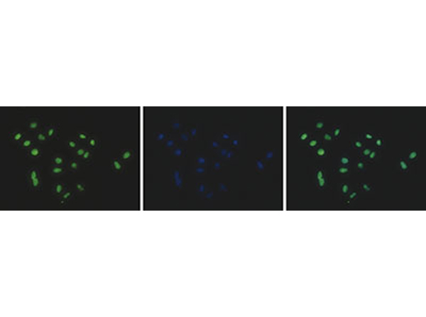 Immunofluorescence using Anti-Histone H2A pan